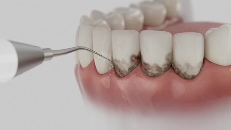 Reliable Tooth Extraction contractor in Howard County County, MO by Dentist Open Now